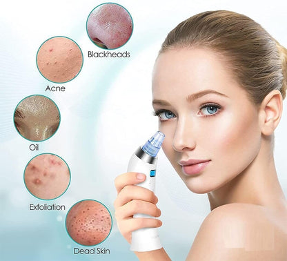 Rarely Found™ GlowGlide Blackhead/Whitehead remover vacuum device