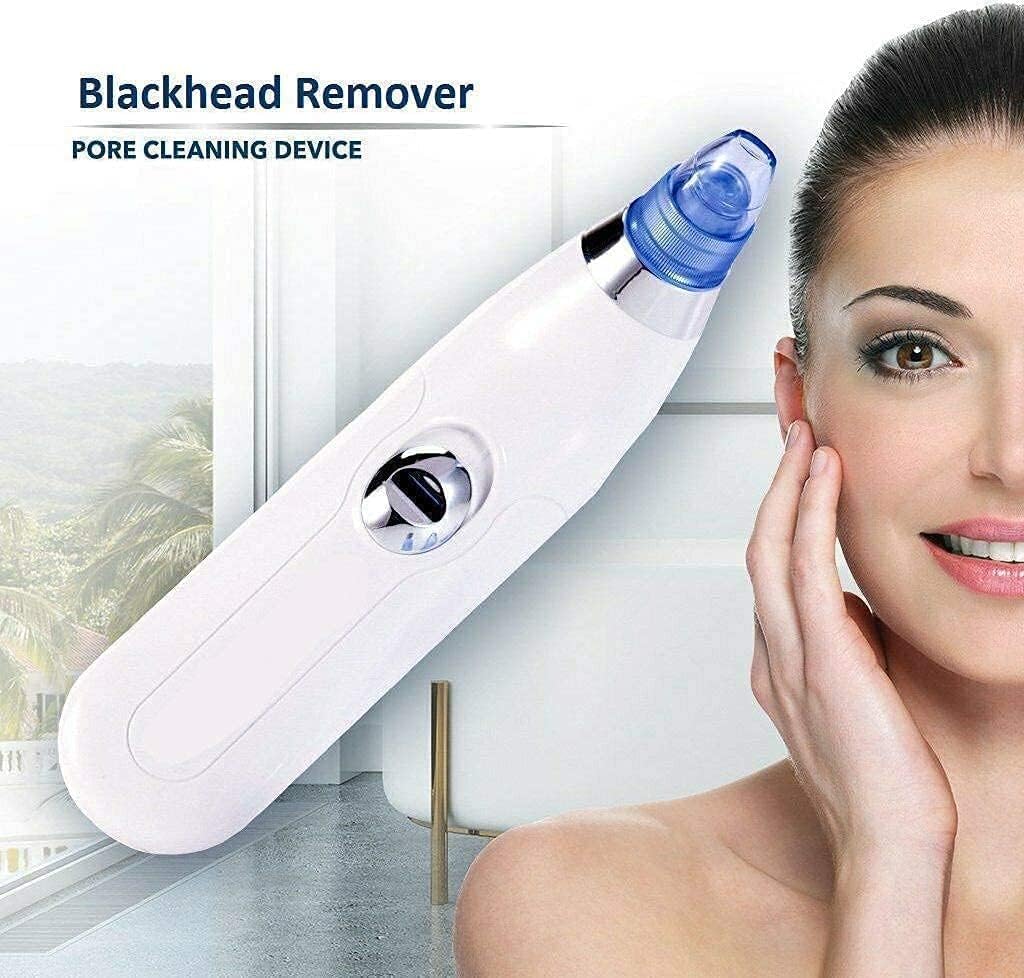 Rarely Found™ GlowGlide Blackhead/Whitehead remover vacuum device