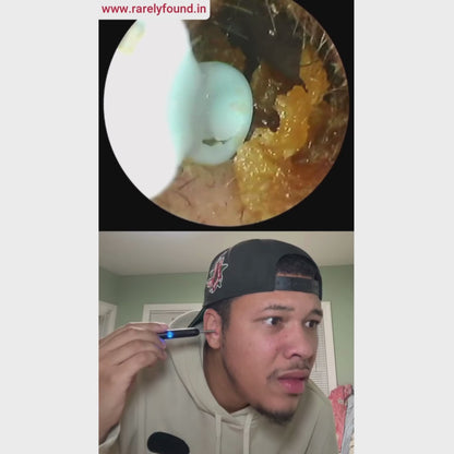 Rarely Found™ Earwax remover with camera